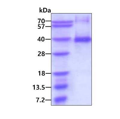 SDS-PAGE Recombinant Human Cyclin G His Protein